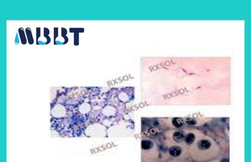 WRIGHTS STAIN for microscopical staining